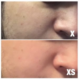 iPhone XSで写真を撮ると肌が自動で綺麗に補正される？